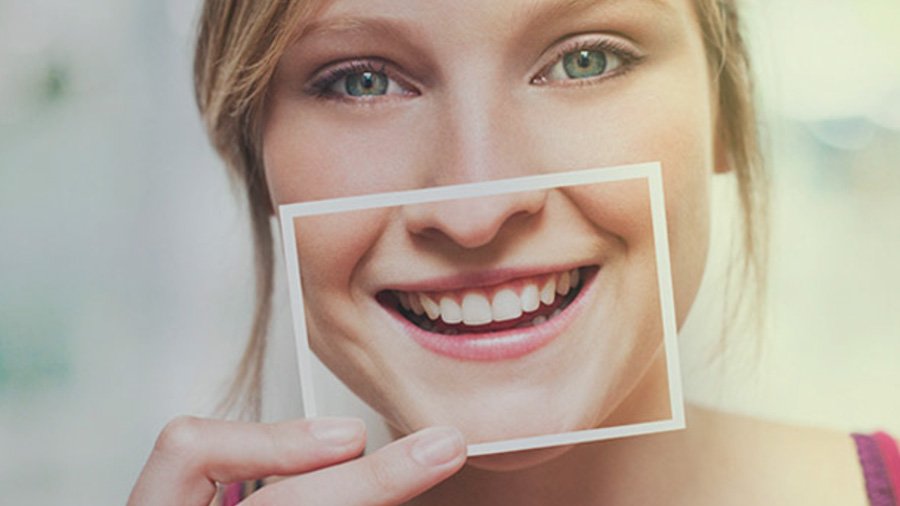 Conheça 4 benefícios do clareamento dental