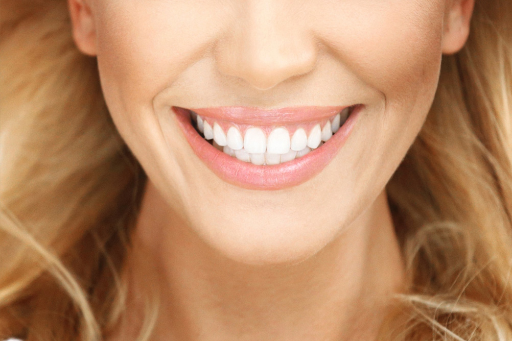 Conheça as principais dúvidas sobre clareamento dental