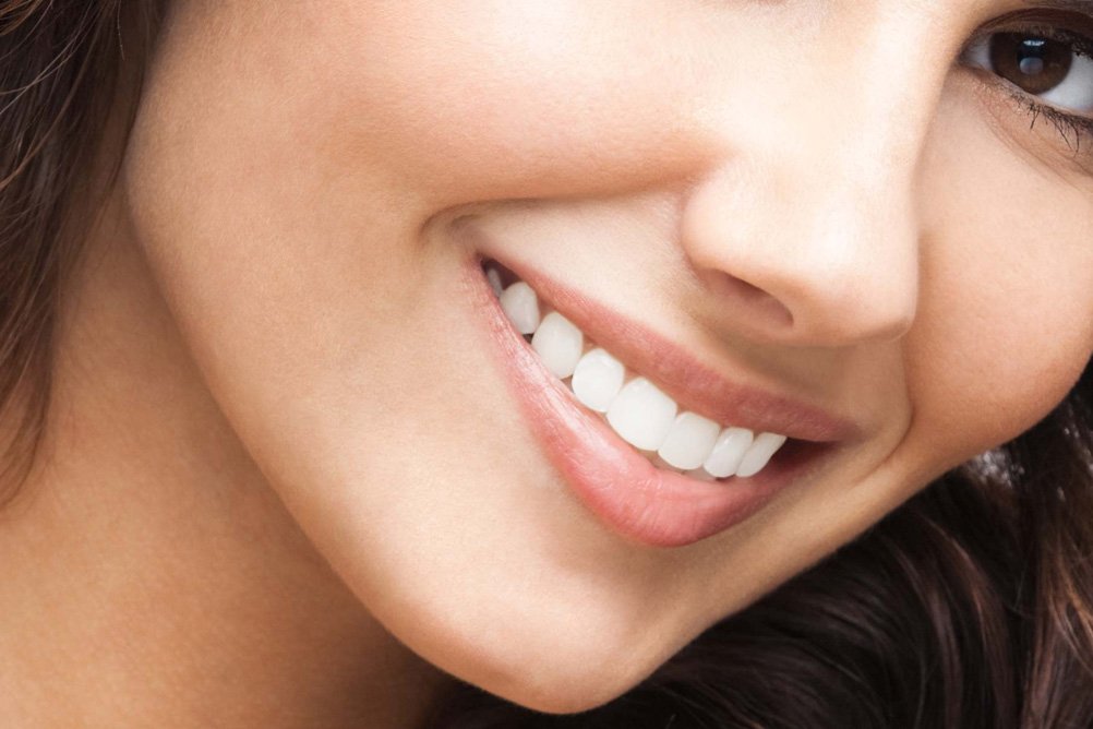 5 dicas para conservar suas facetas ou lentes de contato dental